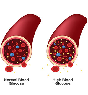 erratic blood sugar