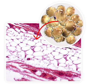 section1 image1